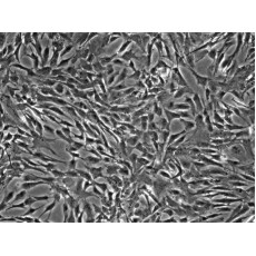 Human Astrocytes (HA)